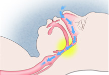 Figure 1: Normal Breathing