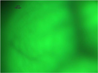 Figure 2 Green fluorescent brain of a GAD67-GFP knock-in mouse