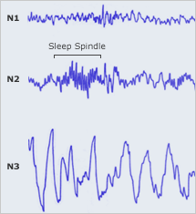 Picture of EEG of NREM sleep