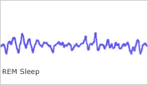 Picture of EEG of REM sleep