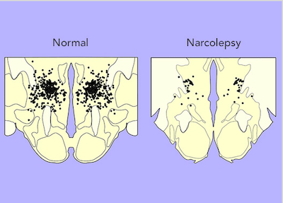 Orexin Brainstem Location