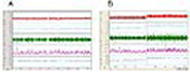 REsponse of a Sham or CIH exposed rat to central injection of endothelin