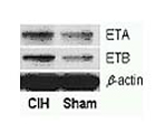Western Blot with increase expressionof receptors of endothelin in carotid body after intermittent hypoxia exposure